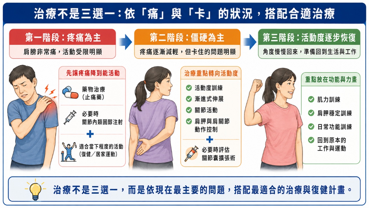 依痛與卡的狀況搭配合適治療